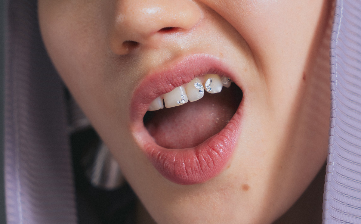 Sonrisa con gemas dentales Swarovski