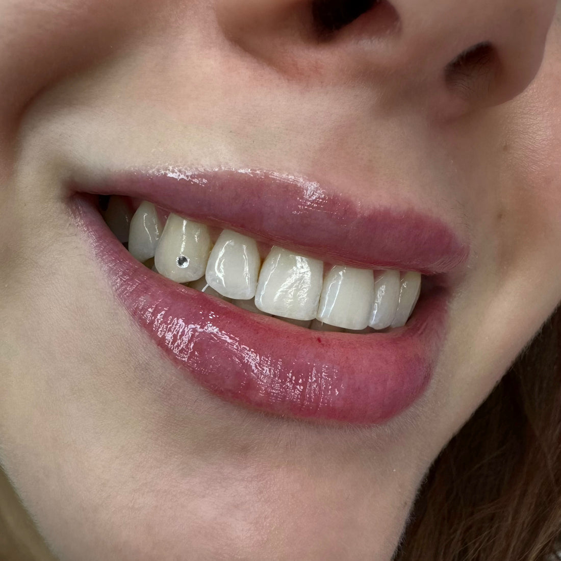 (PRESENCIAL) CURSO INTENSIVO GEMAS DENTALES